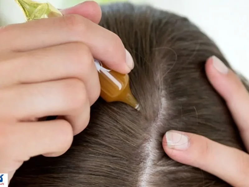 تکنیک ژاپنی ‎ها برای رشد انفجاری موها لو رفت