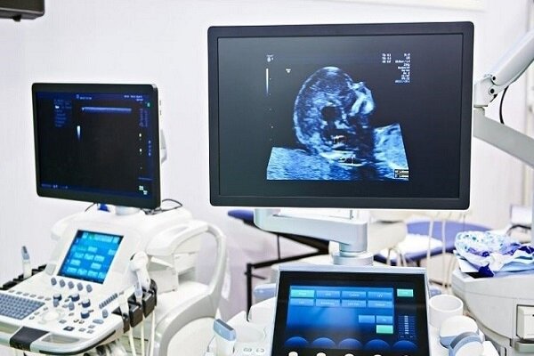 علائم هشداردهنده سرطانهای زنان را نباید نادیده گرفت