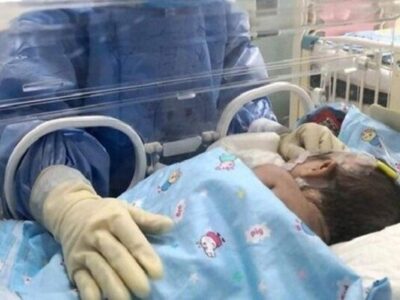 آب حاوی فلوراید، بر وزن هنگام تولد تأثیری ندارد