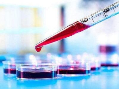 آزمایش خون میتواند بیماری کرون را پیشبینی کند