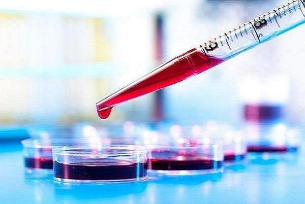 آزمایش خون می‌تواند بیماری کرون را پیش‌بینی کند