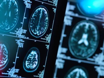 هشدار به بیماران صرعی و آسمی درباره قطع دارو در ایام روزهداری